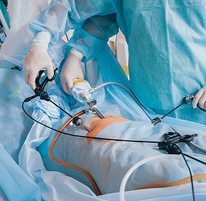 Uro-Oncology Laparoscopy